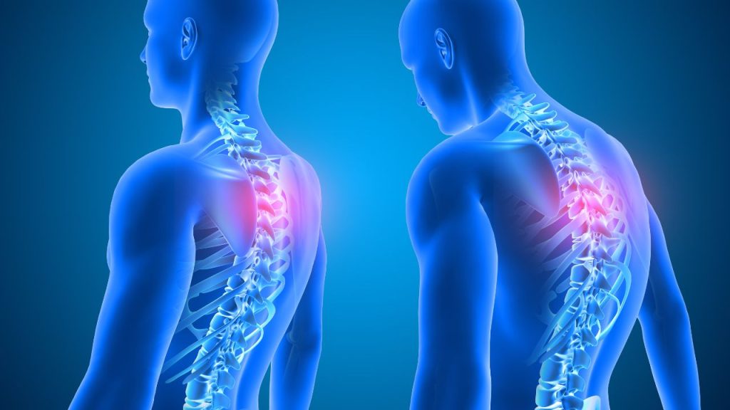 improves posture